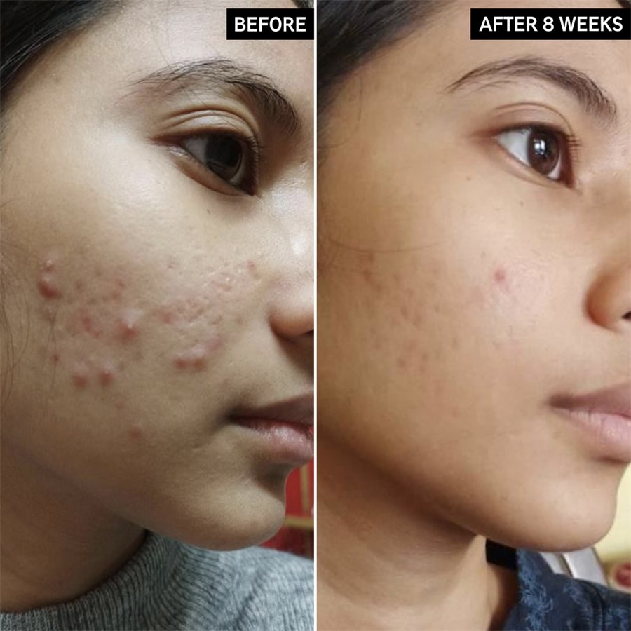 The INKEY List Środki oczyszczające Salicylic Acid Cleanser