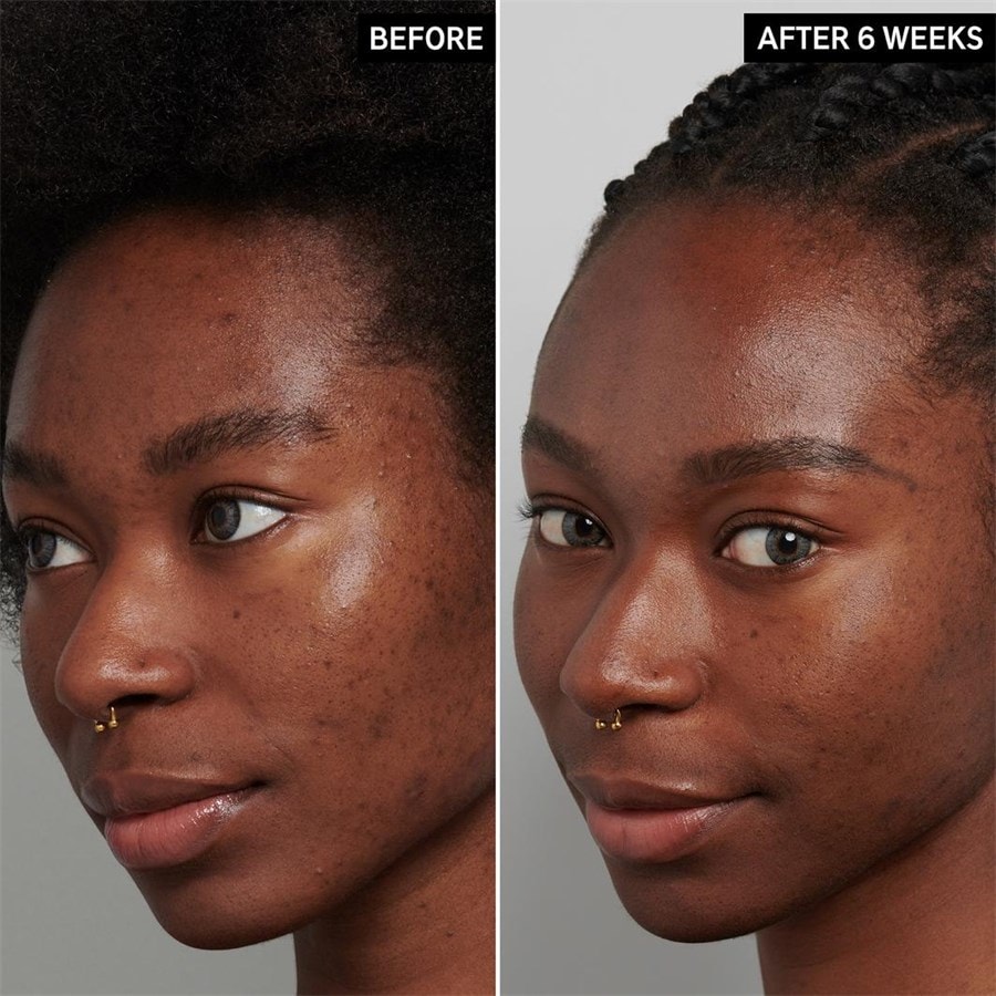 The INKEY List Serum Tranexamic Acid Serum