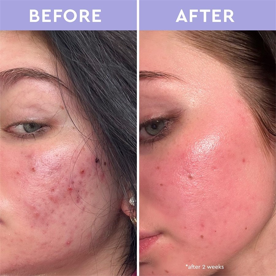 florence by mills Cleanse Spot a Spot Exfoliating Blemish Solution