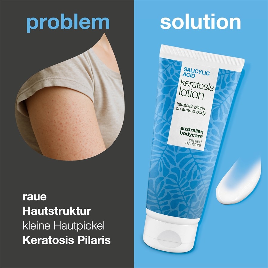 Australian Bodycare Kremy i balsamy do ciała Salicylic Acid Keratosis Lotion
