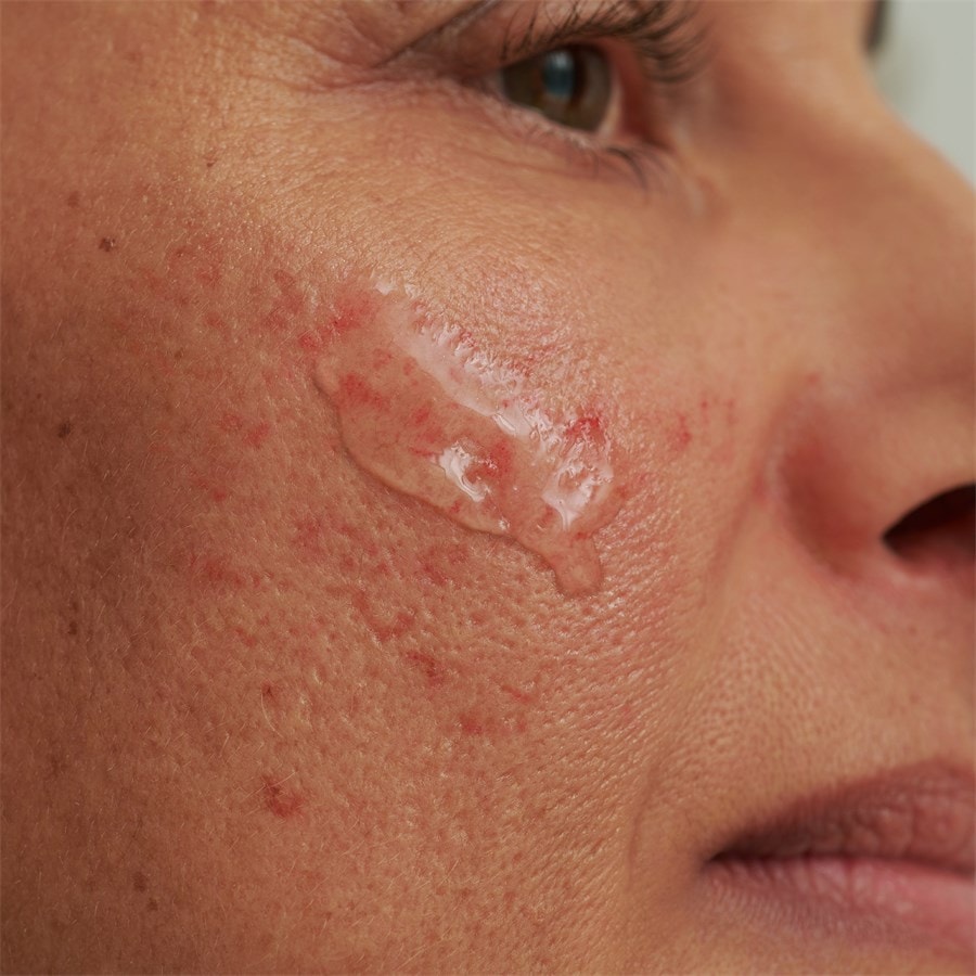 DADO SENS SENSACEA INTENSYWNE SERUM - dla skóry nadwrażliwej i naczynkowej