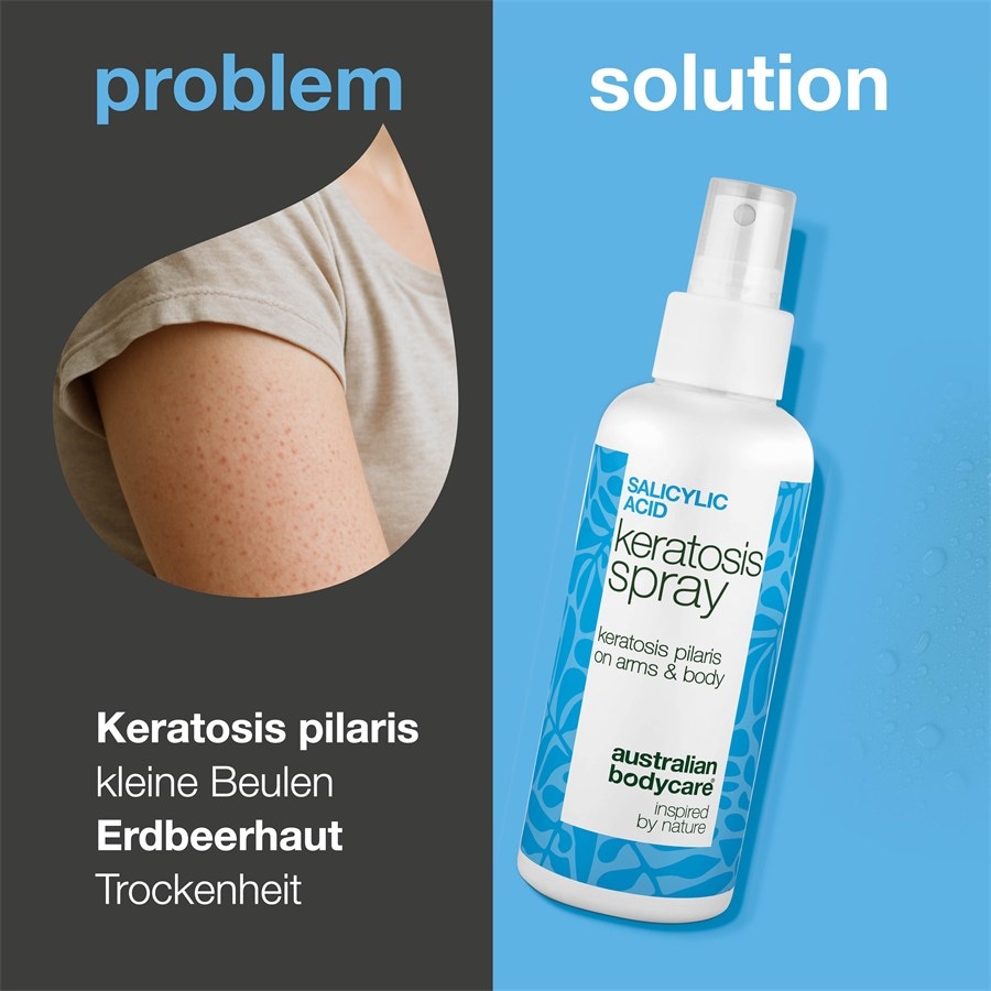 Australian Bodycare Kremy i balsamy do ciała Salicylic Acid Keratosis Spray