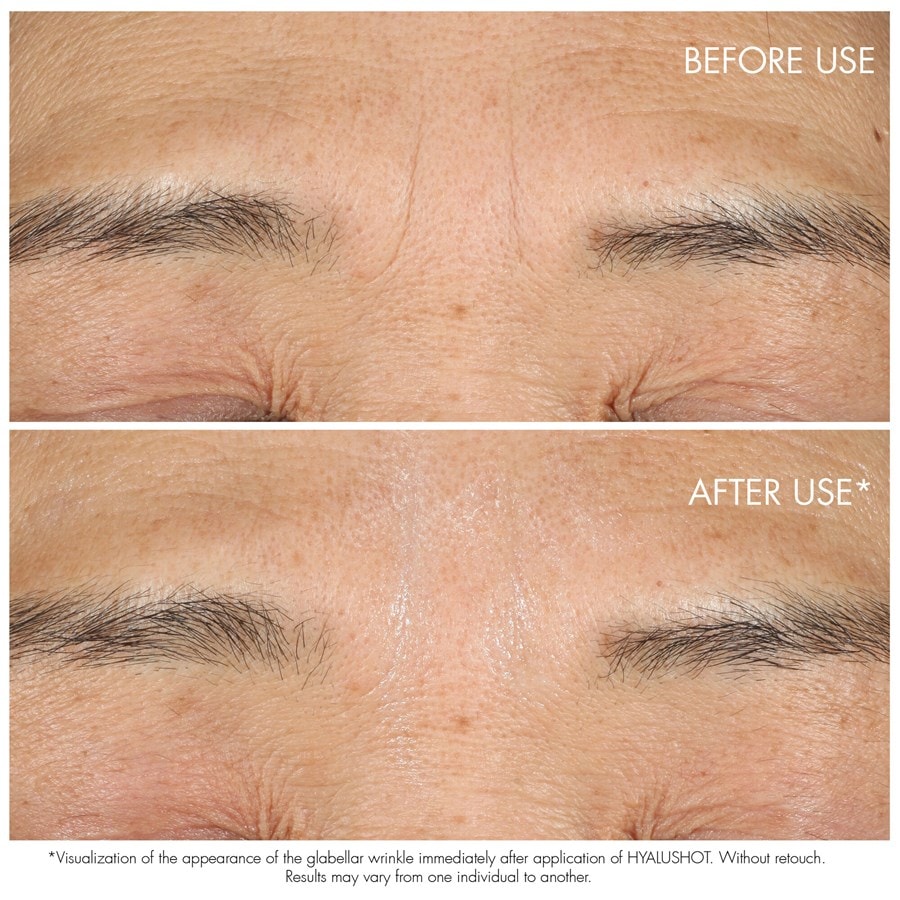DIOR Capture Totale Hyalushot Intensywne serum przeciwzmarszczkowe
