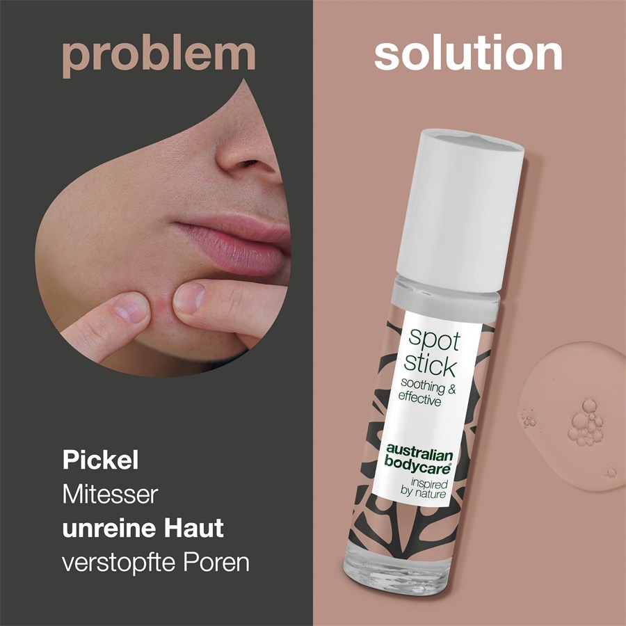Australian Bodycare Pielęgnacja nawilżająca Spot Stick Anti Pickelstift