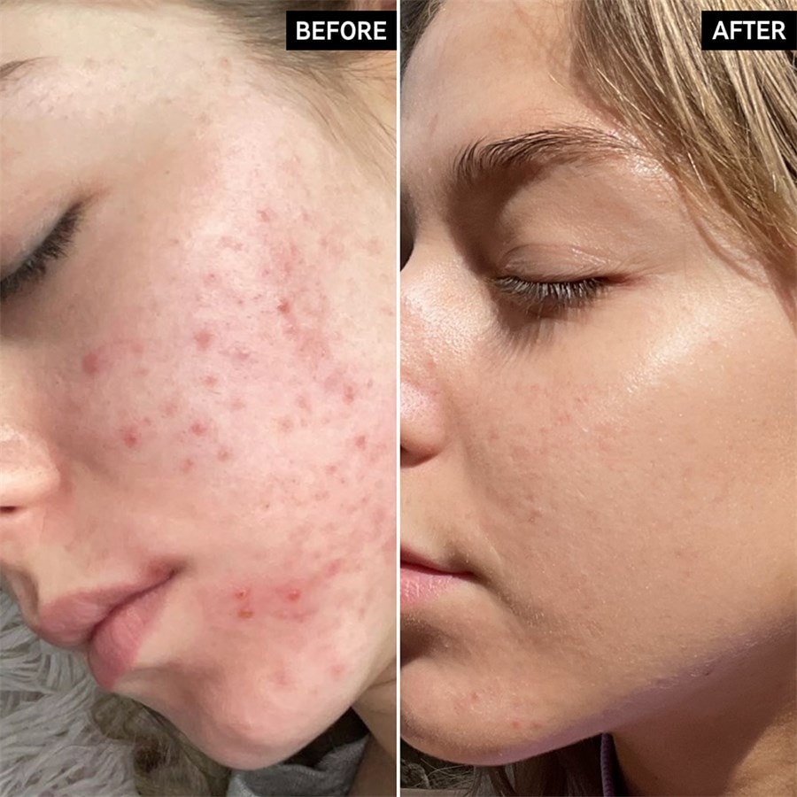 The INKEY List Serum Niacinamide Serum