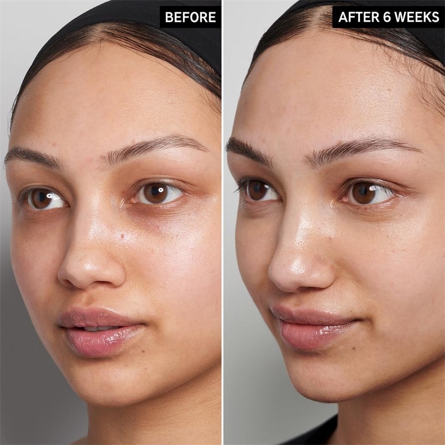 The INKEY List Serum 15% Vitamin C And EGF Serum