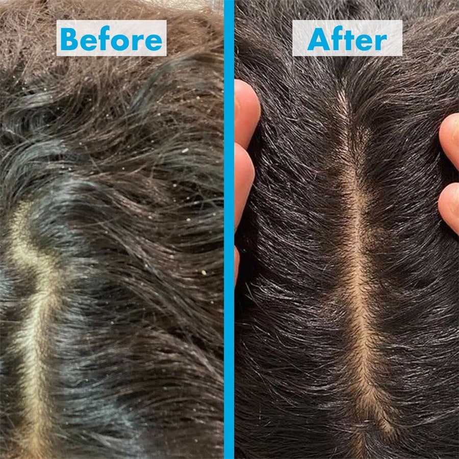 Umberto Giannini Scalp Restore Scalp Reviving Anti-Dandruff Conditioner