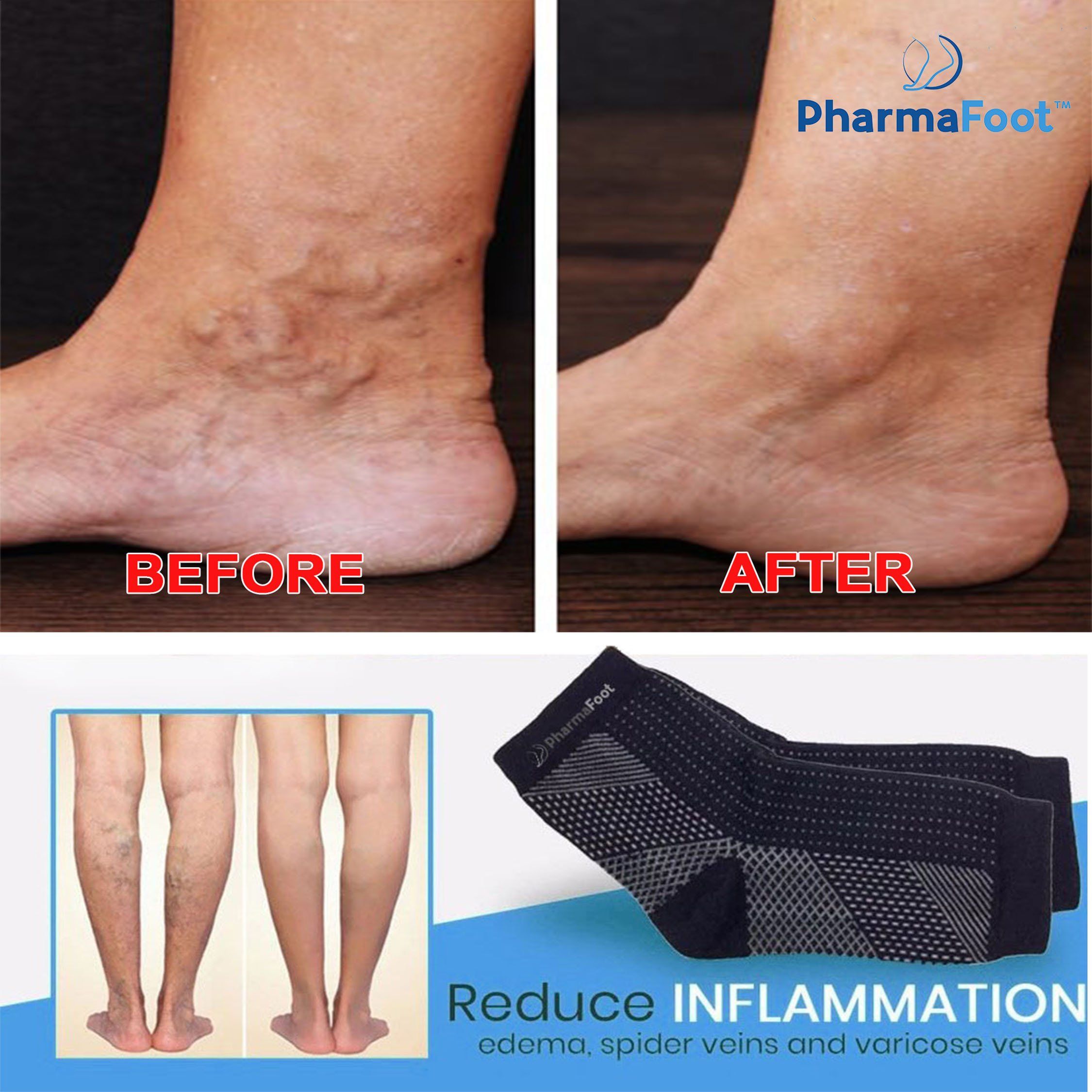 Neuropathy Therapy Socks Lightsoom