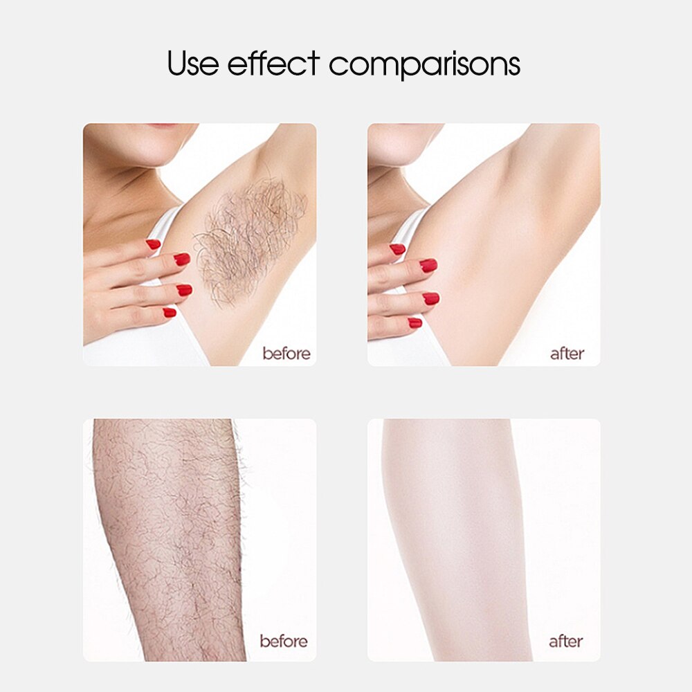 [ZS] 999,999 Flashes IPL 5 Mode Underarm Epilator Painless Whole Body Photoepilator For Women Armpit Laser Pubic Hair Removal