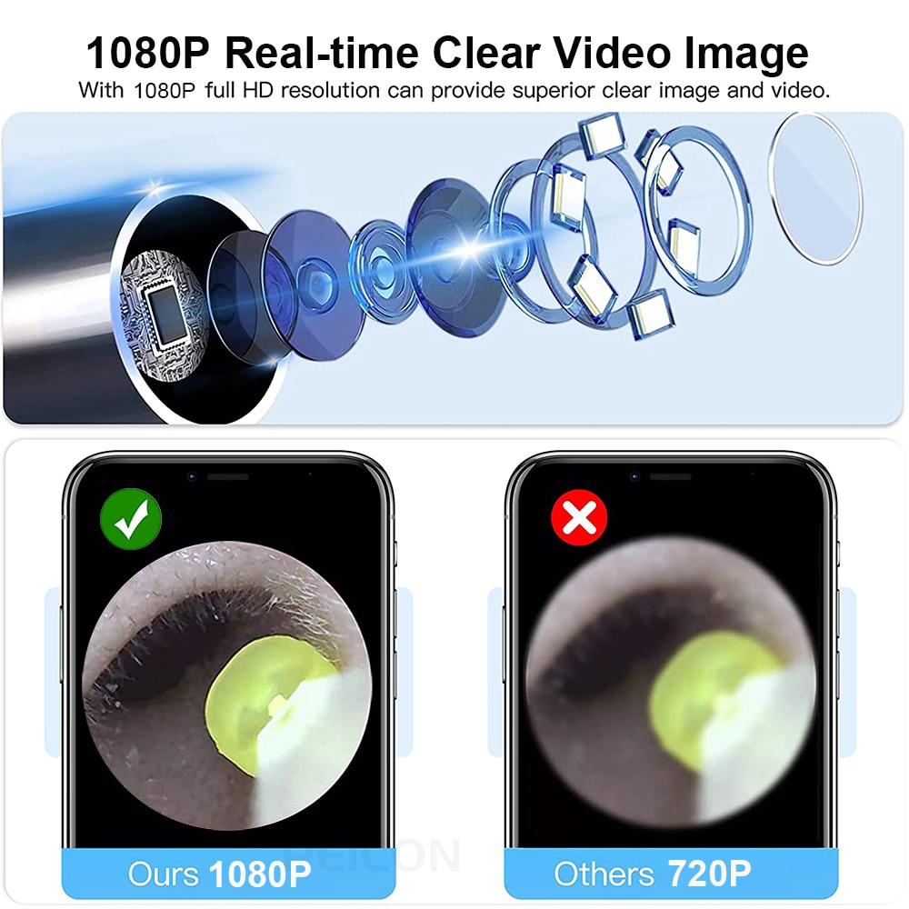 Ear Cleaner Ear Wax Removal With Camera Otoscope 1080P Wireless WIFI Ear Cleaning Kit Smart Visual Ear Stick For IOS Apple