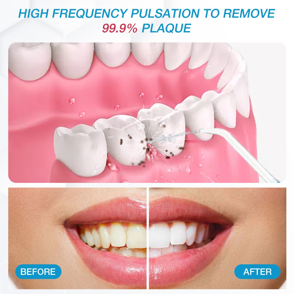 Waterpulse Dental Irrigator 800ml Home Teeth Whitening Water Flosser 10 Modes Oral Irrigators Cleaning Tools V300 For Family