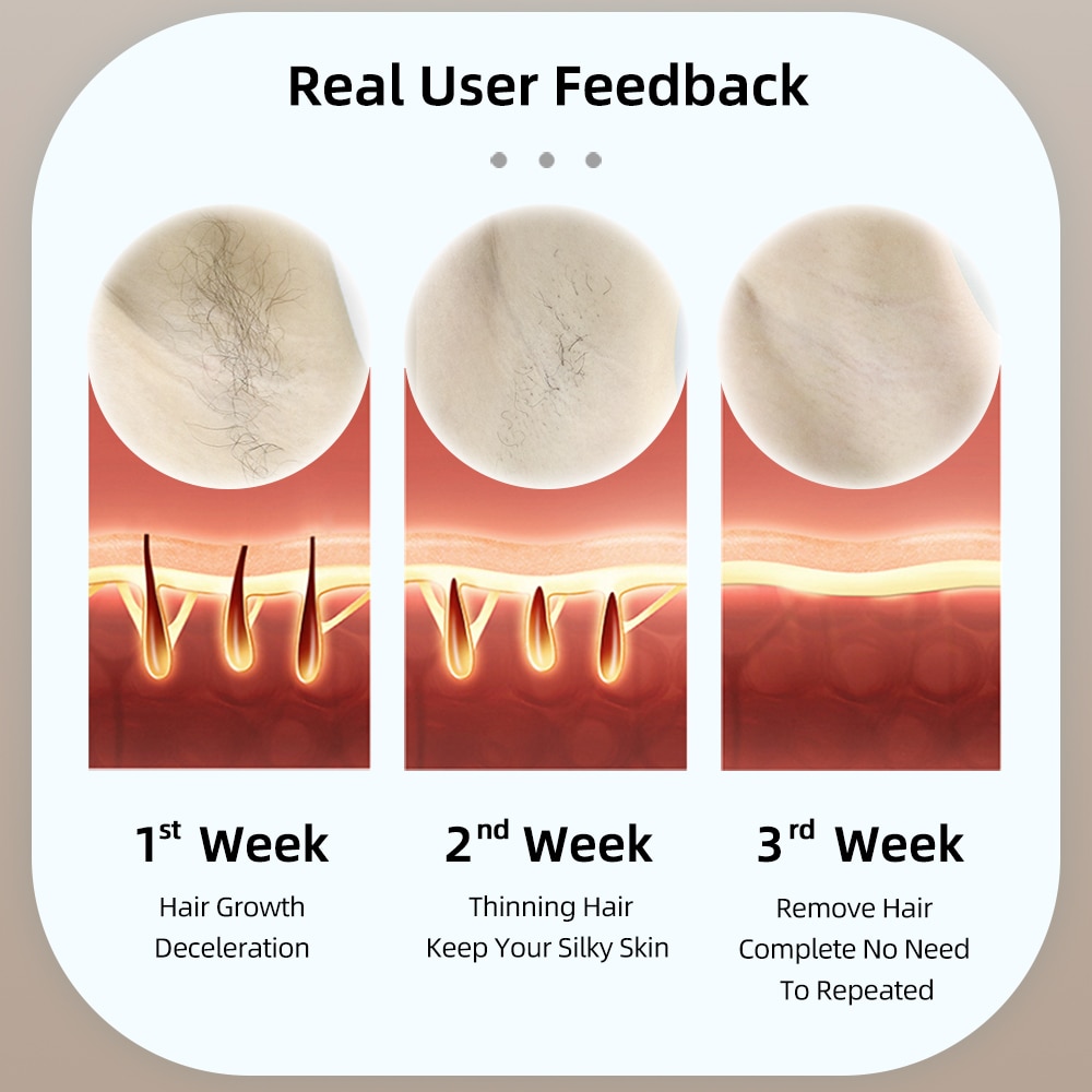 MLAY Laser Mlay T14 Hair Removal IPL Hair Removal ICE Cold Epilator 500000 Flashes 3IN1 Epilator Body Depilador a laser