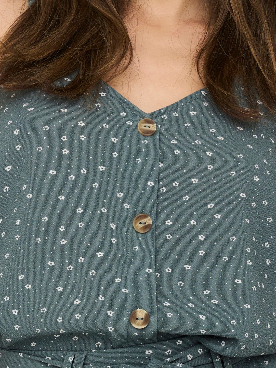 Button detailed Top